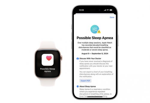 Apple Watch Revolutionizes Sleep Apnea Detection Now Available in Over 150 Countries